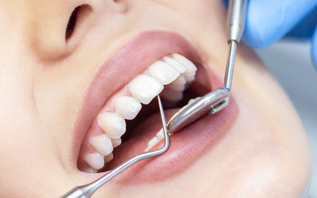 Importance of Regular Teeth Cleaning