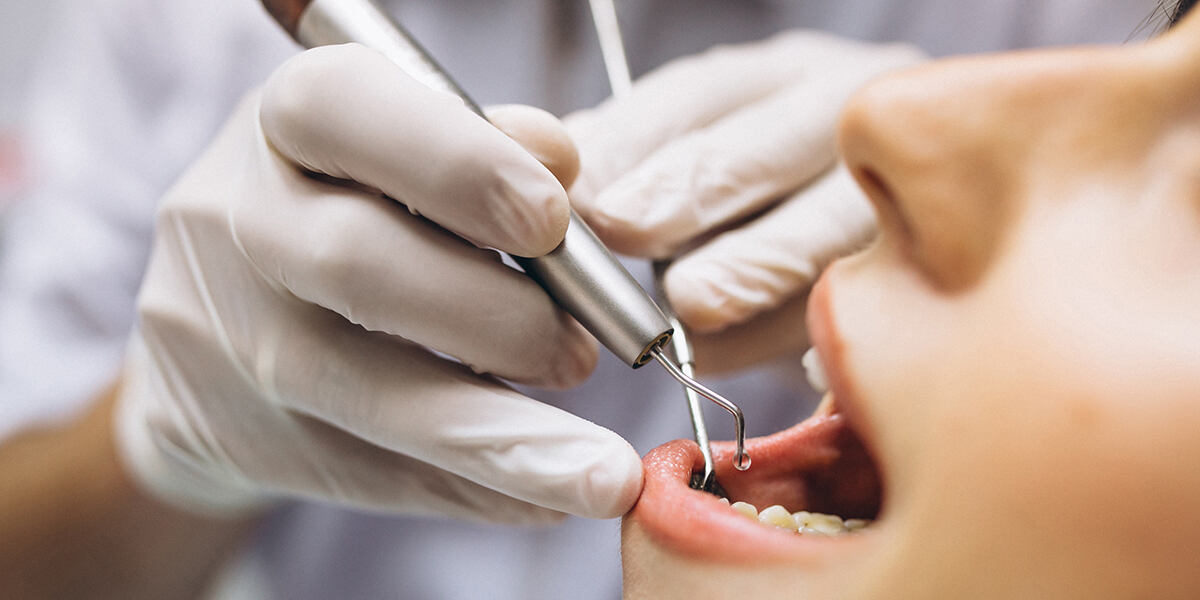 dental implant surgery operate by scarborough dentist