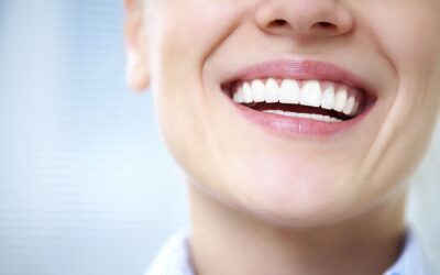 Is Whitening Teeth Safe? Understanding the Risks and Benefits